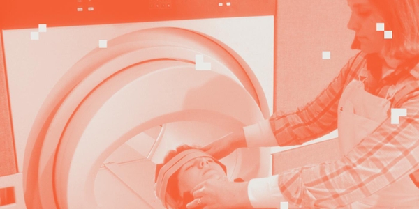 featured image thumbnail for post Low cost MRI scans using deep learning